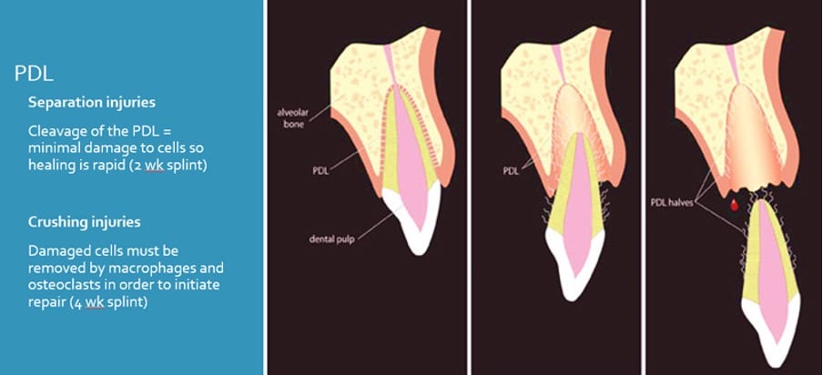 A Guide to the Management of Paediatric Dental Trauma - Fulham Road Dental