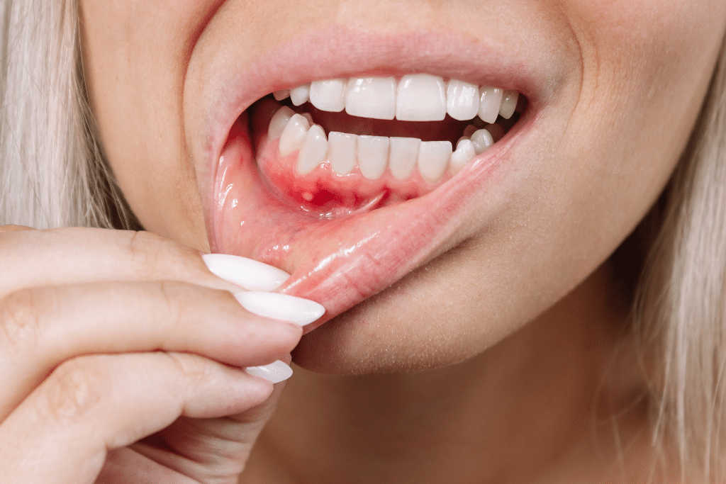 Can Diabetes Affect Your Teeth? The Risks and What to Do - Fulham Road Dental