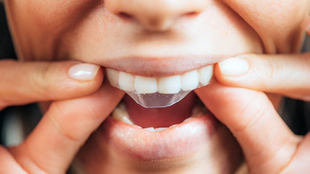 A cosmetic dentist could be your Key to whiter teeth