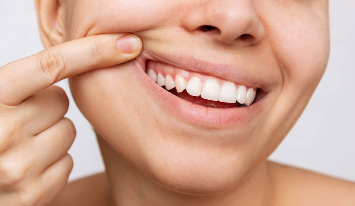 cavities gum disease and misalignment