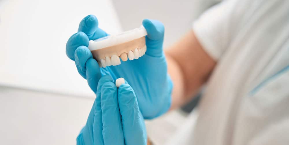 Understanding dental crowns