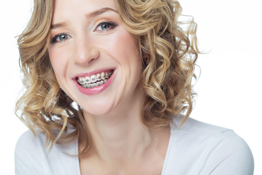 Are adult orthodontic braces right for you