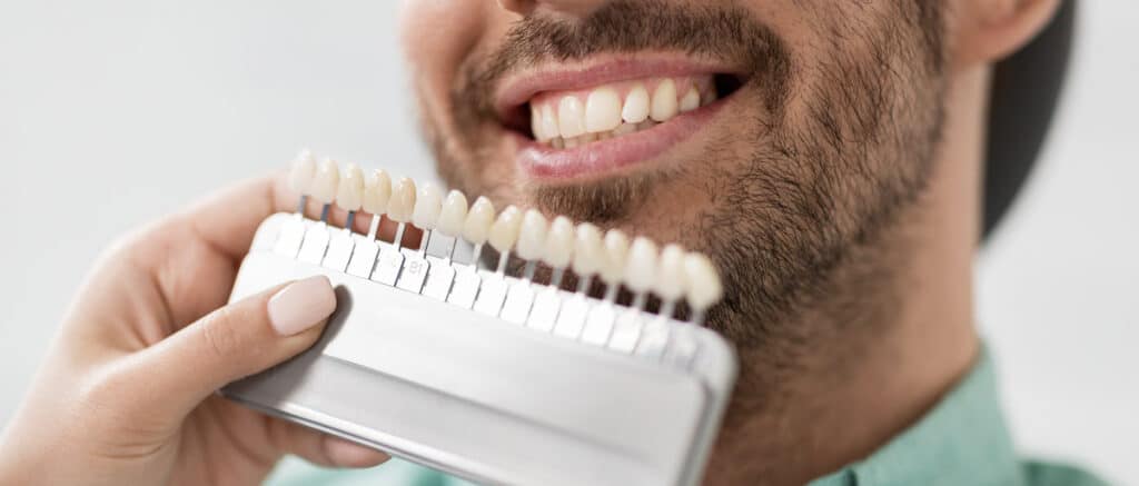 Is the cost of porcelain veneers worth it A comprehensive guide